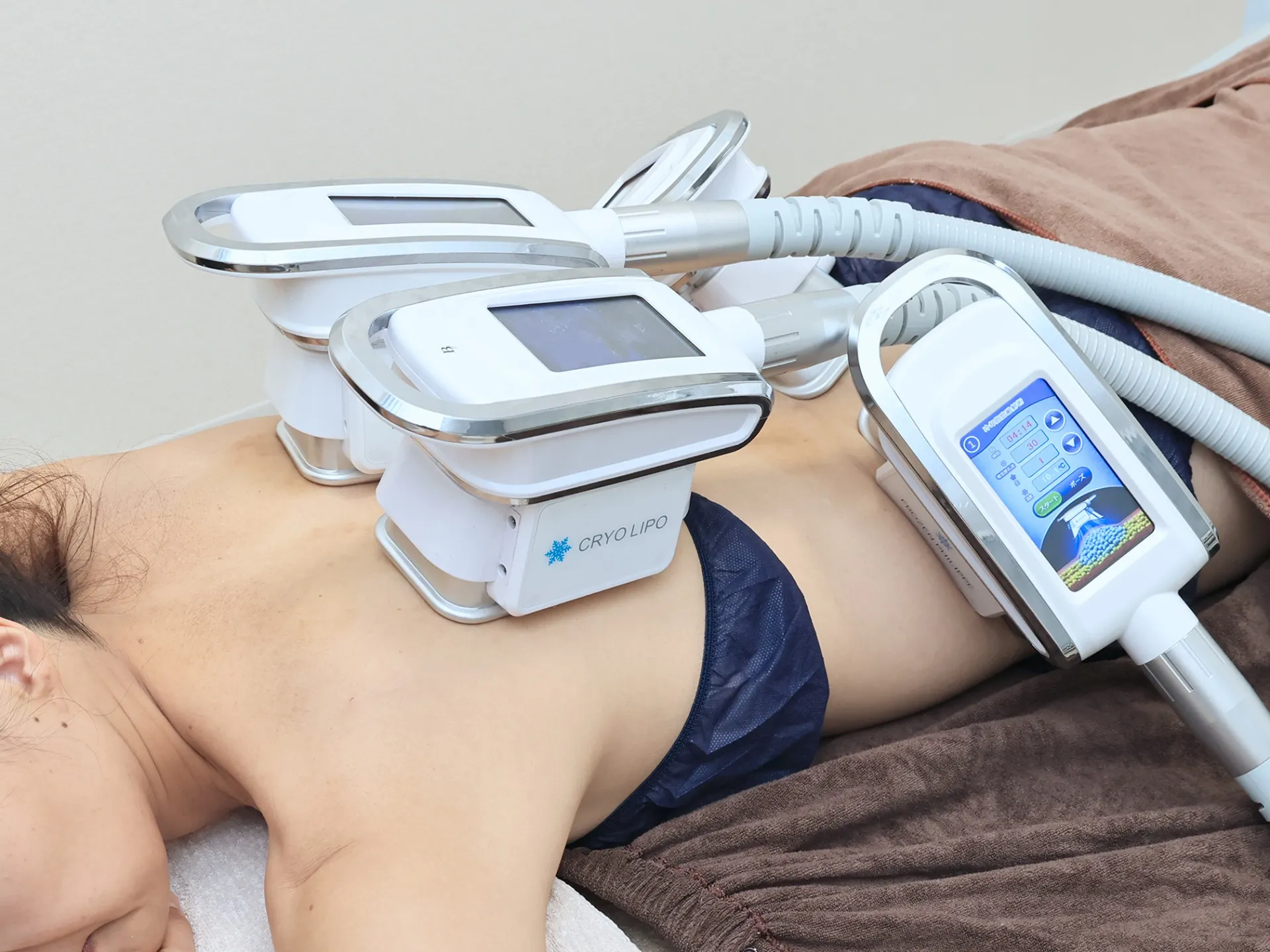 ベスト脂肪冷却!